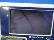 SATURN Biomedical Verathon Glidescope Portable GVL Video Monitor