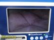 SATURN Biomedical Verathon Glidescope Portable GVL Video Monitor