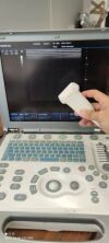 MINDRAY M5 Ultrasound - OB / GYN - Vascular