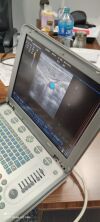 MINDRAY M5 Ultrasound - OB / GYN - Vascular
