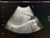 TOSHIBA PVT-375BT Ultrasound Transducer