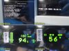 SPACELABS 91367 Ultraview SL Monitor,91496 Command Module, PSU, New Leads