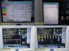 SPACELABS 91367 Ultraview SL Monitor,91496 Command Module, PSU, New Leads