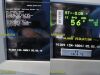 SPACELABS 91369 Ultraview SL, Masimo SpO2 Module Opt: ICGMRS, Leads~ Monitor