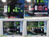 SPACELABS 91369 Ultraview SL, Masimo SpO2 Module Opt: ICGMRS, Leads~ Monitor