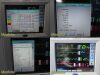 SPACELABS 91369 Ultraview SL, Masimo SpO2 Module Opt: ICGMRS, Leads~ Monitor
