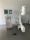 ZIEHM 8000 C-Arm