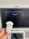 PHILIPS iU22 2010
