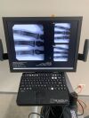 ORTHOSCAN HD Mini C-Arm C-Arm