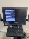 ORTHOSCAN HD Mini C-Arm C-Arm