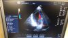GE 3S-RS Ultrasound Transducer