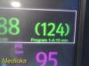 MINDRAY Accutorr 7 (6103F-PA00047) Spot Vitals Monitor