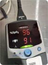 Used Nonin Medical 2500a Oximeter Pulse For Sale Dotmed Listing