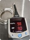 NONIN MEDICAL SpO2 2500 Oximeter - Pulse