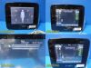 BARD 2018 BD Portable Ultrasound System SiteRite