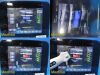 BARD 2018 BD Portable Ultrasound System SiteRite
