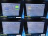 BARD Site Rite Halcyon 2018 Chison Med Tech Diag Ultrasound W/ L7SVA Probe