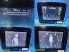 BARD Site Rite Halcyon 2018 Chison Med Tech Diag Ultrasound W/ L7SVA Probe