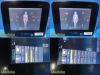 BARD Site Rite Halcyon 2018 Chison Med Tech Diag Ultrasound W/ L7SVA Probe