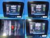 BARD Site Rite Halcyon 2018 Chison Med Tech Diag Ultrasound W/ L7SVA Probe
