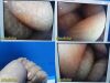 AMERICAN ORTHOPEDIC Smith & Nephew DYONICS 3626 4mmx30° Video Rigid Telescope, Arthroscope