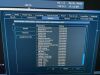 PHILIPS HD15 Ultrasound - Shared Service
