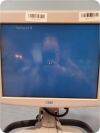 CRYOCATH 10000-008-04 Cryosurgical Unit