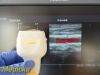 TOSHIBA 2011  PLT-604AT Linear Array Ultrasound Transducer