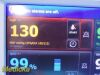 WELCH ALLYN VSM6000 Series Vitals Monitor