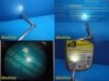 KARL STORZ 28020A Hopkins 0° Berci-Nephroscope W/ Instrument Guide & Cable