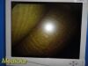 SMITH & NEPHEW Ref 4131 HD Rhinology Scope/ Video Arthroscope