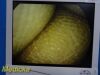 SMITH & NEPHEW Ref 4131 HD Rhinology Scope/ Video Arthroscope