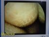 SMITH & NEPHEW Ref 4131 HD Rhinology Scope/ Video Arthroscope