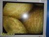 SMITH & NEPHEW 4131 Rigid Telescope,2.7mmx30° Arthroscope