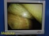 SMITH & NEPHEW 4131 Rigid Telescope,2.7mmx30° Arthroscope