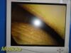 SMITH & NEPHEW 4131 Rigid Telescope,2.7mmx30° Arthroscope