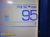 WELCH ALLYN Hill-Rom WA Spot Vital Signs LXI Monitor