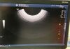GE IC5-9-D Ultrasound Transducer