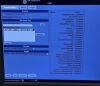 GE LOGIQ E9 Ultrasound Machine