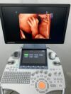 GE Voluson S10 BT22 Ultrasound - OB / GYN