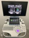 GE Voluson S10 BT22 Ultrasound - OB / GYN