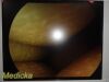 RICHARD WOLF Panoview Plus 8880.402 25° Arthroscope Rigid Telescope
