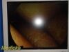 RICHARD WOLF Panoview Plus 8880.402 25° Arthroscope Rigid Telescope