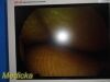 RICHARD WOLF Panoview Plus 8880.402 25° Arthroscope Rigid Telescope