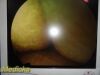 RICHARD WOLF Panoview Plus 8880.402 25° Arthroscope Rigid Telescope
