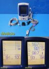 WELCH ALLYN 45NT0 Spot Vitals Monitor