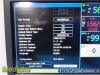 PHILIPS Healthcare VSM4 Vitals Monitor