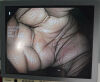 OLYMPUS CF-H180DL Video Colonoscope Colonoscope