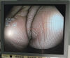 OLYMPUS CF-H180DL Video Colonoscope Colonoscope