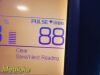WELCH ALLYN 2014 Hillrom  Spot Vital Signs LXI  Monitor,Nellcor SpO2,2 Leads